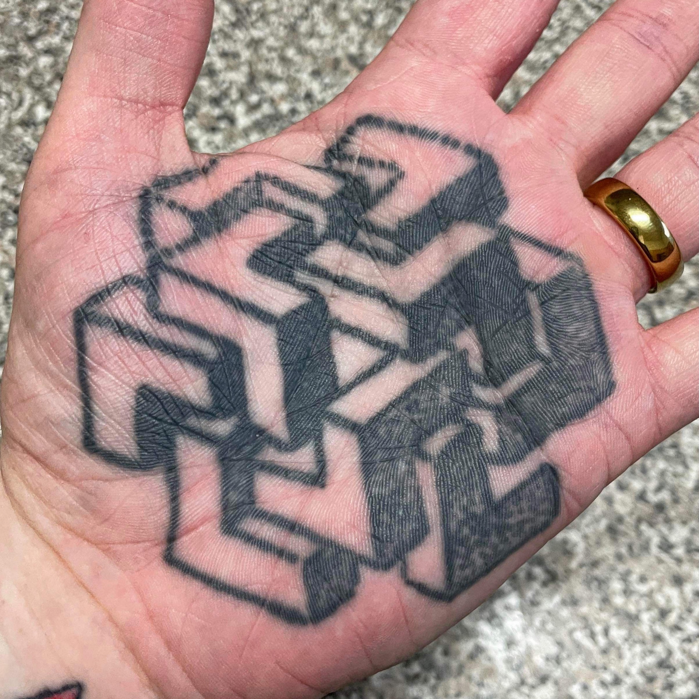 Two-year healed palm